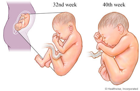 3-trimester-1