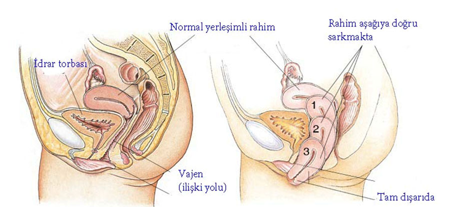 rahim-sarkmasi-1