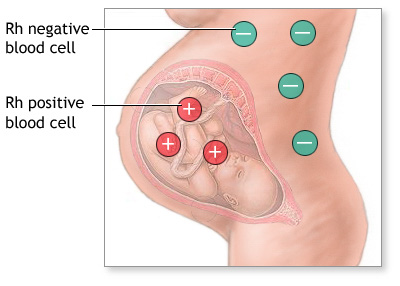 rh-negatif-kadinlarin-gebeligi-1
